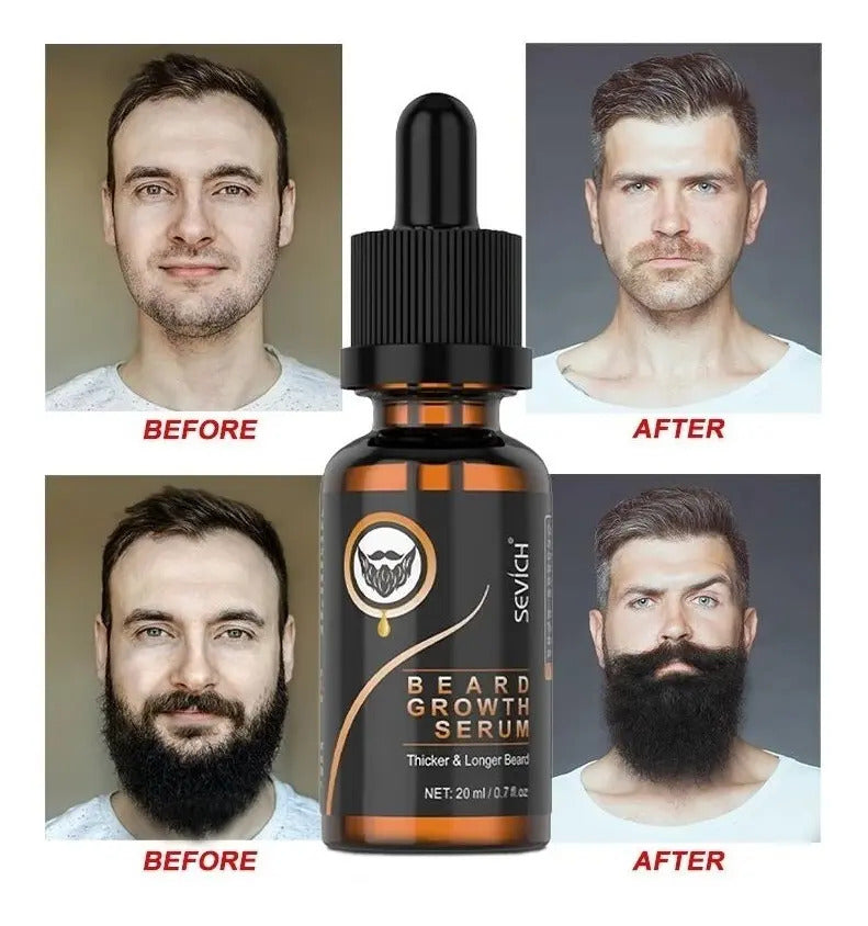 Kit de Cuidado para Barba Profesional - Aceite, Bálsamo y Cepillo de Madera