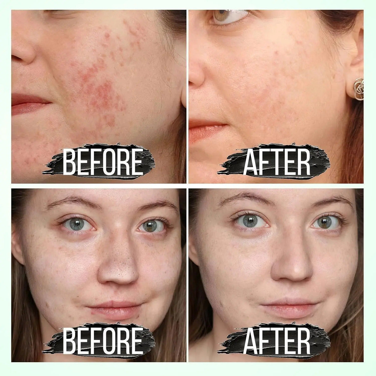 Mascarilla Facial Flower Secret - Limpieza Profunda de Puntos Negros y Acné