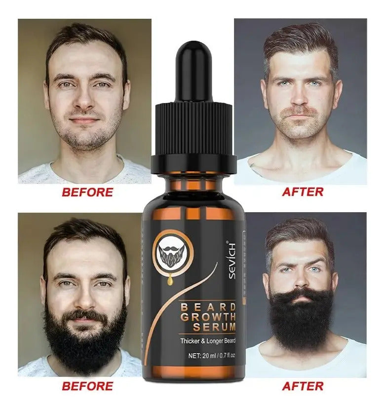 Kit de Cuidado para Barba Profesional - Aceite, Bálsamo y Cepillo de Madera