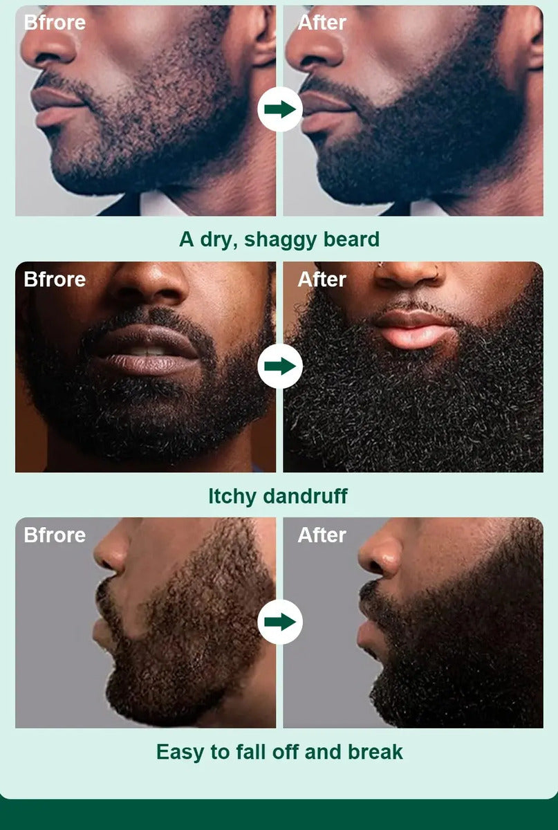 Shampoo para Barba Sevich 100ml - Con Extracto de Árbol de Té y Vitaminas